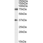 abx431468 (0.3 µg/ml) staining of Human Brain (Cerebellum) lysate (35 µg protein in RIPA buffer). Primary incubation was 1 hour. Detected by chemiluminescence.