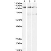 abx431479 (1 µg/ml) staining of U937 (A) and (0.3 µg/ml) A431 (B) and HepG2 (C) cell lysate (35 µg protein in RIPA buffer). Detected by chemiluminescence.