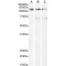 Oncostatin M Receptor (OSMR) Antibody