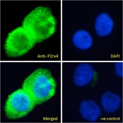 Purinergic Receptor P2X 4 (P2rx4) Antibody