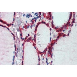 Peroxiredoxin 1 (PRDX1) Antibody