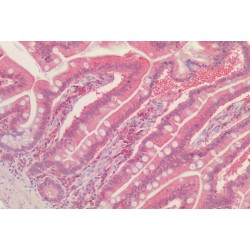 Peroxiredoxin 1 (PRDX1) Antibody