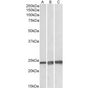 abx431485 (0.1 µg/ml) staining lysate of cell line HEK293 (A), A431 (B) and HepG2 (C) (35 µg protein in RIPA buffer). Primary incubation was 1 hour. Detected by chemiluminescence.