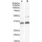 Paired Box 8 (PAX8) Antibody