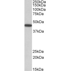 Pre-B-Cell Leukemia Transcription Factor 1 (PBX1) Antibody