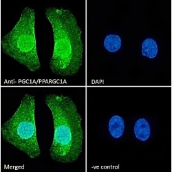 Peroxisome Proliferator Activated Receptor Gamma Coactivator 1 Alpha (PPARGC1A) Antibody