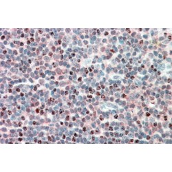 Multicatalytic Endopeptidase Complex Subunit MECl-1 (MECL1) Antibody