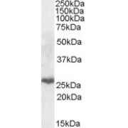 abx431524 (0.3 µg/ml) staining of Human Lung lysate (35 µg protein in RIPA buffer). Primary incubation was 1 hour. Detected by chemiluminescence.