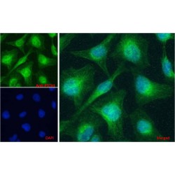 Protein Patched Homolog 1 (PTCH1) Antibody