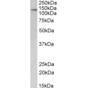 Western blot analysis of Mouse Fetal Kidney lysate (35 µg protein in RIPA buffer) using PTCH1 antibody (2 µg/ml).