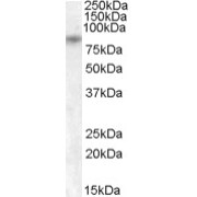 abx431550 (1 µg/ml) staining of Human Pancreas lysate (35 µg protein in RIPA buffer). Primary incubation was 1 hour. Detected by chemiluminescence.