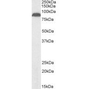 Western blot analysis of Human Pancreas lysate (35 µg protein in RIPA buffer) using biotin-conjugated Transient Receptor Potential Cation Channel Subfamily V Member 5 (TRPV5) Antibody (2 µg/ml, 1 hour), exactly mirroring its parental non-Primary incubation was 1 hour. Detected by chemiluminescence, using streptavidin-HRP and using NAP blocker as a substitute for skimmed milk.