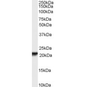 abx431557 (0.3 µg/ml) staining of human skin lysate (35 µg protein in RIPA buffer). Primary incubation was 1 hour. Detected by chemiluminescence.