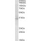 11-Cis Retinol Dehydrogenase (RDH5) Antibody