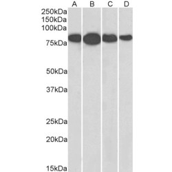 Radixin (RDX) Antibody