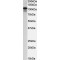 SATB Homeobox 1 (SATB1) Antibody