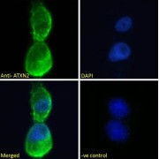 abx431573 Immunofluorescence analysis of paraformaldehyde fixed A431 cells, permeabilized with 0.15% Triton. Primary incubation 1hr (10 µg/ml) followed by AF488 secondary antibody (2 µg/ml), showing cytoplasmic staining. The nuclear stain is DAPI (blue). Negative control: Unimmunized goat IgG (10 µg/ml) followed by AF488 secondary antibody (2 µg/ml).