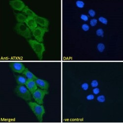 Ataxin 2 (ATXN2) Antibody