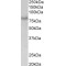 Single-Minded Homolog 1 (SIM1) Antibody