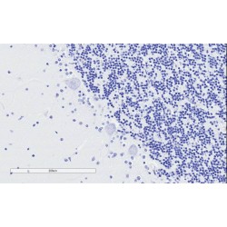 Synaptosomal-Associated Protein 25 (SNAP25) Antibody