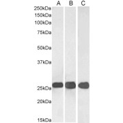 abx431595 (0.03 µg/ml) staining of Human Cerebellum (A), Mouse (B) and (0.05 µg/ml) Rat Brain (C) lysate (35 µg protein in RIPA buffer). Detected by chemiluminescence.