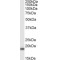 Superoxide Dismutase 1 (SOD1) Antibody