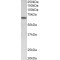 Sex Determining Region Y Box Protein 11 (SOX11) Antibody