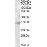 abx431613 (1 µg/ml) staining of Mouse Spleen lysate (35 µg protein in RIPA buffer). Primary incubation was 1 hour. Detected by chemiluminescence.