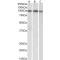 Signal Transducer And Activator of Transcription 5A (STAT5A) Antibody