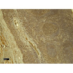 Signal Transducer And Activator of Transcription 5A (STAT5A) Antibody