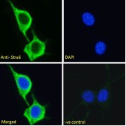 abx431621 Immunofluorescence analysis of paraformaldehyde fixed NIH3T3 cells, permeabilized with 0.15% Triton. Primary incubation 1hr (10 µg/ml) followed by AF488 secondary antibody (2 µg/ml), showing plasma membrane/cytoplasmic staining. The nuclear stain is DAPI (blue). Negative control: Unimmunized goat IgG (10 µg/ml) followed by AF488 secondary antibody (2 µg/ml).