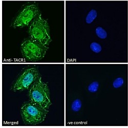 Tachykinin Receptor 1 (TACR1) Antibody