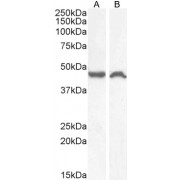 Western blot analysis of extracts of HeLa (A) and Neuro2a (B) cell lysate (35 µg protein in RIPA buffer) using TACR1 antibody ((A): 1 µg/ml, (B): 0.5 µg/ml).