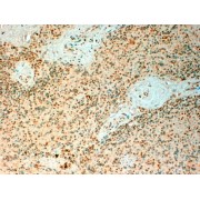 IHC-P analysis of paraffin embedded Human Spleen tissue using TET2 antibody (4 µg/ml).