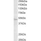 Transmembrane Protease Serine 4 (TMPRSS4) Antibody