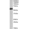 Aldehyde Dehydrogenase 5 Family Member A1 (ALDH5A1) Antibody