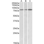 abx431650 (0.3 µg/ml) staining of Human Cerebral Cortex (A), Human Frontal Cortex (B) and Mouse Brain lysates (35 µg protein in RIPA buffer). Primary incubation was 1 hour. Detected by chemiluminescence.