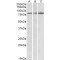 PAP Associated Domain Containing 5 (PAPD5) Antibody