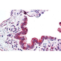 Calcium-Binding Atopy-Related Autoantigen 1 (CBARA1) Antibody