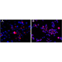 Centrosomal Protein 290 kDa (CEP290) Antibody