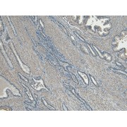 abx431654 (5 µg/ml) staining of paraffin embedded Human Prostate. Heat induced antigen retrieval with citrate buffer pH 6, HRP-staining.