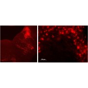 abx431655 (0.5 µg/ml staining of paraffin embedded Mouse Brain stem in sagittal (left) and coronal (right) sections of Raphe nuclei. Detection Alexa 594. Data obtained from Prof. D Crane, Griffith Univeristy, Brisbane, Australia