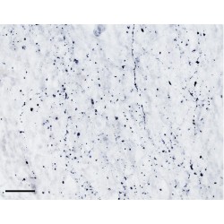 Tryptophan Hydroxylase 2 (TPH2) Antibody