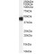 Cerebral Cavernous Malformations 2 Protein (CCM2) Antibody