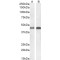 Arrestin Beta 2 (ARRB2) Antibody