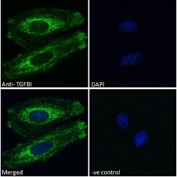Transforming Growth Factor Beta Induced Protein (TGFBI) Antibody