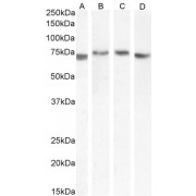 abx431665 (0.3 µg/ml) staining of Human Kidney (A), Colorectal cancer (B), (0.1 µg/ml) Human Prostate (C) and Rat Kidney (D) lysate (35 µg protein in RIPA buffer). Detected by chemiluminescence.