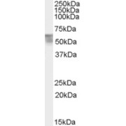 Western blot analysis of Human Bone Marrow lysate (35 µg protein in RIPA buffer) using Thyroid Hormone Receptor Alpha (THRA) Antibody (0.5 µg/ml). Detected by chemiluminescence.