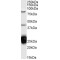 Nucleolysin TIA-1 Isoform P40 (TIA1) Antibody
