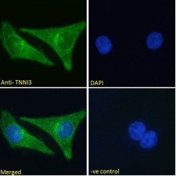 Troponin I, Cardiac Muscle (TNNI3) Antibody